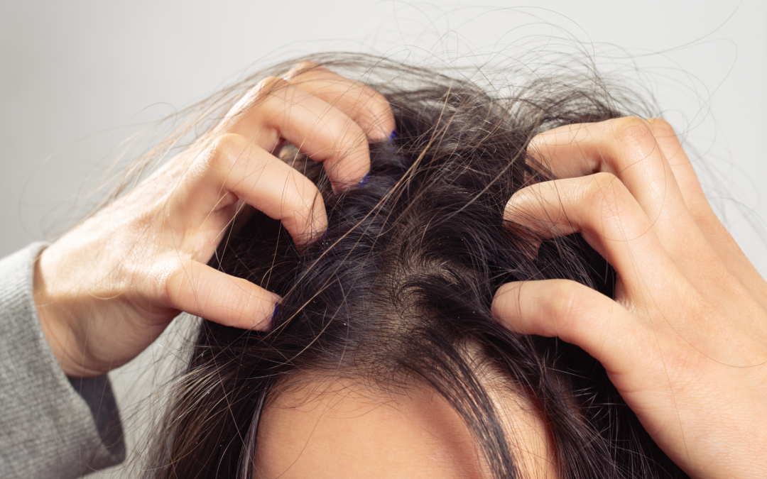 Things You Should Know If You Are Dealing With An Itchy Scalp
